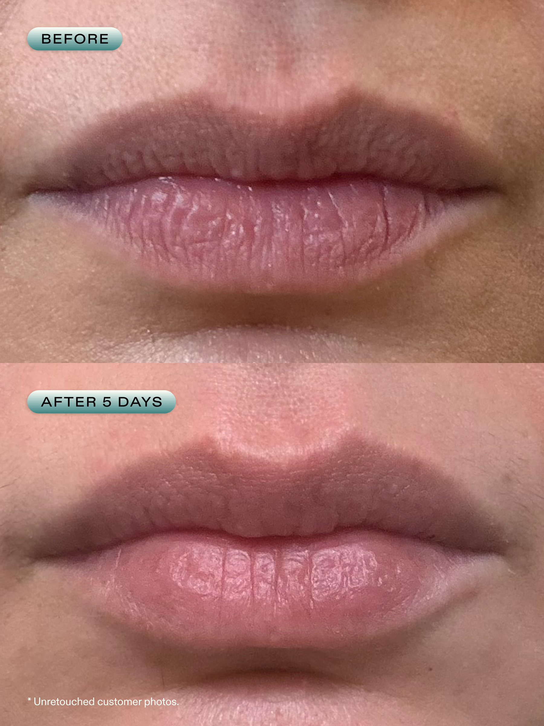 Lip Barrier Relief - Image 6